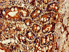 OAS1 Antibody - Immunohistochemistry of paraffin-embedded human small intestine tissue at dilution of 1:100