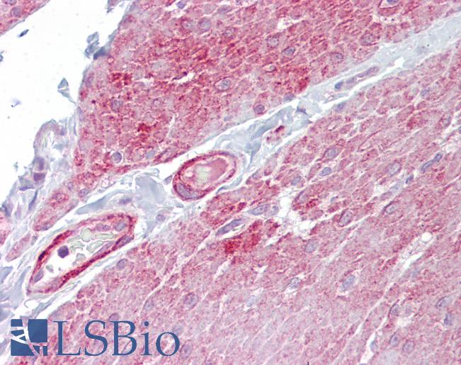 OAS1 Antibody - Anti-OAS1 antibody IHC of human small intestine. Immunohistochemistry of formalin-fixed, paraffin-embedded tissue after heat-induced antigen retrieval. Antibody concentration 5 ug/ml.  This image was taken for the unconjugated form of this product. Other forms have not been tested.