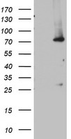 OAS2 Antibody - HEK293T cells were transfected with the pCMV6-ENTRY control (Left lane) or pCMV6-ENTRY OAS2 (Right lane) cDNA for 48 hrs and lysed. Equivalent amounts of cell lysates (5 ug per lane) were separated by SDS-PAGE and immunoblotted with anti-OAS2.