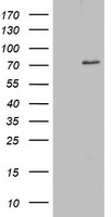 OAS2 Antibody - HEK293T cells were transfected with the pCMV6-ENTRY control (Left lane) or pCMV6-ENTRY OAS2 (Right lane) cDNA for 48 hrs and lysed. Equivalent amounts of cell lysates (5 ug per lane) were separated by SDS-PAGE and immunoblotted with anti-OAS2.