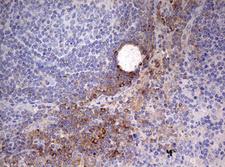 OAS2 Antibody - IHC of paraffin-embedded Human lymph node tissue using anti-OAS2 mouse monoclonal antibody. (Heat-induced epitope retrieval by 10mM citric buffer, pH6.0, 120°C for 3min).