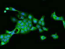 OAS2 Antibody - Immunofluorescence staining of OAS2 in A431 cells. Cells were fixed with 4% PFA, permeabilzed with 0.3% Triton X-100 in PBS, blocked with 10% serum, and incubated with rabbit anti-Human OAS2 polyclonal antibody (dilution ratio 1:200) at 4°C overnight. Then cells were stained with the Alexa Fluor 488-conjugated Goat Anti-rabbit IgG secondary antibody (green) and counterstained with DAPI (blue). Positive staining was localized to Nucleus and Cytoplasm.