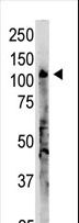 OAS3 / p100 Antibody - The anti-OAS3 C-term Antibody is used in Western blot to detect OAS3 in A375 lysate.