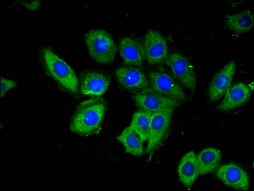 OAS3 / p100 Antibody - Immunofluorescent analysis of A549 cells using OAS3 Antibody at a dilution of 1:100 and Alexa Fluor 488-congugated AffiniPure Goat Anti-Rabbit IgG(H+L)