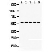 OASIS / CREB3L1 Antibody - CREB3L1 antibody Western blot. All lanes: Anti CREB3L1 at 0.5 ug/ml. Lane 1: Human Placenta Tissue Lysate at 50 ug. Lane 2: HELA Whole Cell Lysate at 40 ug. Lane 3: A549 Whole Cell Lysate at 40 ug. Lane 4: MM231 Whole Cell Lysate at 40 ug. Lane 5: COLO320 Whole Cell Lysate at 40 ug. Predicted band size: 57 kD. Observed band size: 57 kD.
