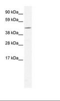 OASIS / CREB3L1 Antibody - Fetal small Intestine Lysate.  This image was taken for the unconjugated form of this product. Other forms have not been tested.