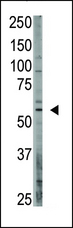 OASIS / CREB3L1 Antibody - The anti-OASIS C-term Antibody is used in Western blot to detect OASIS in A375 lysate.