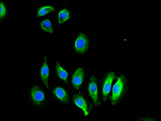 OASIS / CREB3L1 Antibody - Immunofluorescent analysis of A549 cells using CREB3L1 Antibody at a dilution of 1:100 and Alexa Fluor 488-congugated AffiniPure Goat Anti-Rabbit IgG(H+L)