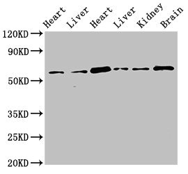 OASIS / CREB3L1 Antibody - Western Blot Positive WB detected in: Rat heart tissue, Rat liver tissue, Mouse heart tissue, Mouse liver tissue, Mouse kidney tissue, Mouse brain tissue All lanes: CREB3L1 antibody at 3.4µg/ml Secondary Goat polyclonal to rabbit IgG at 1/50000 dilution Predicted band size: 58, 48 kDa Observed band size: 58 kDa