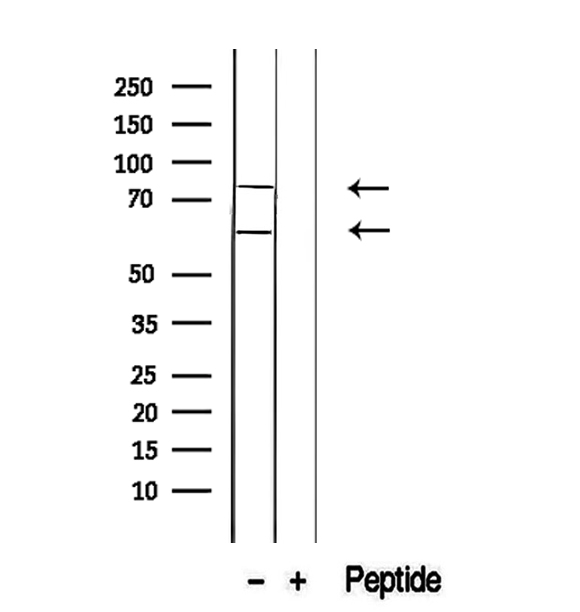 OASIS / CREB3L1 Antibody - Western blot analysis of extracts of COLO 320 using CREB3L1, OASIS antibody.