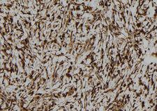 OASIS / CREB3L1 Antibody - 1:100 staining human gastric tissue by IHC-P. The sample was formaldehyde fixed and a heat mediated antigen retrieval step in citrate buffer was performed. The sample was then blocked and incubated with the antibody for 1.5 hours at 22°C. An HRP conjugated goat anti-rabbit antibody was used as the secondary.