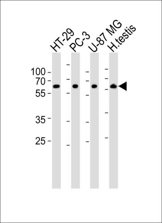 OASL Antibody - Western blot of lysates from HT-29, PC-3, U-87 MG cell line and human testis tissue lysate(from left to right), using OASL Antibody T499. Antibody was diluted at 1:1000 at each lane. A goat anti-rabbit IgG H&L (HRP) at 1:10000 dilution was used as the secondary antibody. Lysates at 35ug per lane.