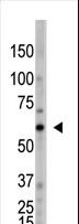 OASL Antibody - The anti-OASL C-term Antibody is used in Western blot to detect OASL in HL60 lysate.