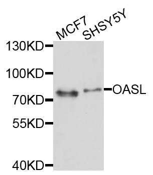 OASL Antibody - Western blot analysis of extracts of various cell lines, using OASL antibody at 1:1000 dilution. The secondary antibody used was an HRP Goat Anti-Rabbit IgG (H+L) at 1:10000 dilution. Lysates were loaded 25ug per lane and 3% nonfat dry milk in TBST was used for blocking. An ECL Kit was used for detection and the exposure time was 60s.