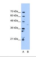 OAT Antibody - Lane A: Marker. Lane B: HepG2 cell lysate. Antibody concentration: 5.0 ug/ml. Gel concentration: 12%.  This image was taken for the unconjugated form of this product. Other forms have not been tested.