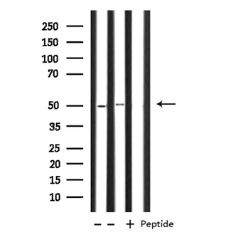OAT Antibody - Western blot analysis of extracts of K562/COLO205 cells using OAT antibody.