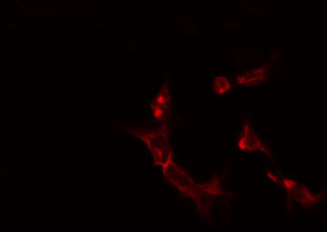 OAT Antibody - Staining K562 cells by IF/ICC. The samples were fixed with PFA and permeabilized in 0.1% Triton X-100, then blocked in 10% serum for 45 min at 25°C. The primary antibody was diluted at 1:200 and incubated with the sample for 1 hour at 37°C. An Alexa Fluor 594 conjugated goat anti-rabbit IgG (H+L) Ab, diluted at 1/600, was used as the secondary antibody.
