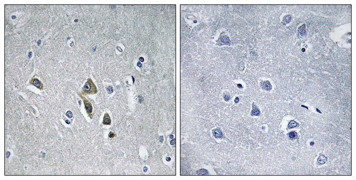 OAZ1 / OAZ Antibody - Immunohistochemistry analysis of paraffin-embedded human brain tissue, using OAZ1 Antibody. The picture on the right is blocked with the synthesized peptide.