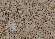 OAZ2 Antibody - 1:100 staining rat liver tissue by IHC-P. The sample was formaldehyde fixed and a heat mediated antigen retrieval step in citrate buffer was performed. The sample was then blocked and incubated with the antibody for 1.5 hours at 22°C. An HRP conjugated goat anti-rabbit antibody was used as the secondary.