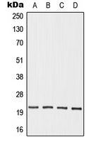 OAZ3 Antibody - Western blot analysis of OAZ3 expression in HEK293T (A); Jurkat (B); mouse testis (C); rat testis (D) whole cell lysates.