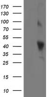 OBFC1 Antibody - HEK293T cells were transfected with the pCMV6-ENTRY control (Left lane) or pCMV6-ENTRY OBFC1 (Right lane) cDNA for 48 hrs and lysed. Equivalent amounts of cell lysates (5 ug per lane) were separated by SDS-PAGE and immunoblotted with anti-OBFC1.