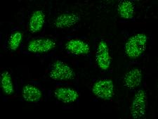 OBFC1 Antibody - Immunofluorescence staining of OBFC1 in U251MG cells. Cells were fixed with 4% PFA, permeabilzed with 0.3% Triton X-100 in PBS, blocked with 10% serum, and incubated with rabbit anti-Human OBFC1 polyclonal antibody (dilution ratio 1:1000) at 4°C overnight. Then cells were stained with the Alexa Fluor 488-conjugated Goat Anti-rabbit IgG secondary antibody (green). Positive staining was localized to nucleus.