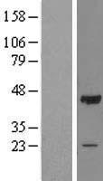 OBFC1 Protein - Western validation with an anti-DDK antibody * L: Control HEK293 lysate R: Over-expression lysate