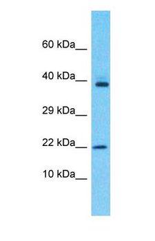 OBP2A Antibody - Western blot of OBP2A Antibody with human MCF7 Whole Cell lysate.  This image was taken for the unconjugated form of this product. Other forms have not been tested.