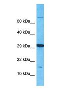 OBP2B Antibody - Western blot of OBP2B Antibody with human 786-0 Whole Cell lysate.  This image was taken for the unconjugated form of this product. Other forms have not been tested.