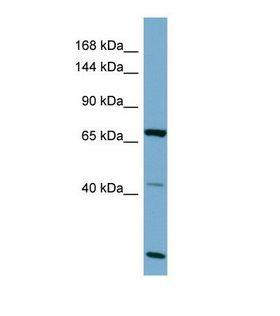 OCA2 / P protein Antibody - Western blot of Human OVCAR-3. OCA2 antibody dilution 1.0 ug/ml.  This image was taken for the unconjugated form of this product. Other forms have not been tested.