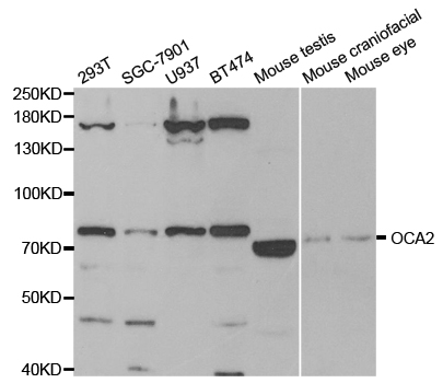OCA2 / P protein Antibody - Western blot analysis of extracts of various cell lines.