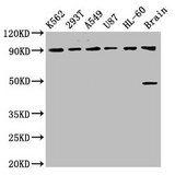 OCA2 / P protein Antibody - Positive Western Blot detected in K562 whole cell lysate, 293T whole cell lysate, A549 whole cell lysate, U87 whole cell lysate, HL-60 whole cell lysate, Rat brain tissue. All lanes: OCA2 antibody at 8.93 µg/ml Secondary Goat polyclonal to rabbit IgG at 1/50000 dilution. Predicted band size: 93, 91, 75 KDa. Observed band size: 93 KDa