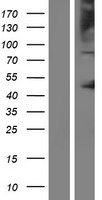 OCA2 / P protein Protein - Western validation with an anti-DDK antibody * L: Control HEK293 lysate R: Over-expression lysate