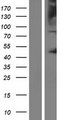 OCA2 / P protein Protein - Western validation with an anti-DDK antibody * L: Control HEK293 lysate R: Over-expression lysate