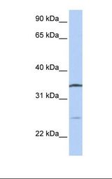 OCIAD1 Antibody - Jurkat cell lysate. Antibody concentration: 1.0 ug/ml. Gel concentration: 12%.  This image was taken for the unconjugated form of this product. Other forms have not been tested.