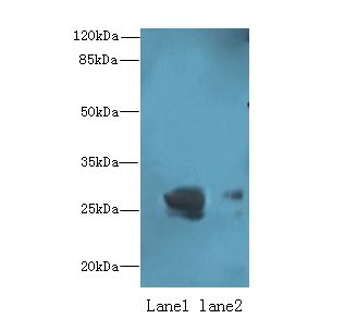 OCIAD1 Antibody - Western blot. All lanes: OCIAD1 antibody at 1 ug/ml. Lane 1: Mouse liver tissue. Lane 2: Mouse kidney tissue. Secondary Goat polyclonal to Rabbit IgG at 1:10000 dilution. Predicted band size: 28 kDa. Observed band size: 28 kDa.