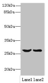 OCIAD1 Antibody - Western blot All lanes: OCIAD1 antibody at 1µg/ml Lane 1: Mouse liver tissue Lane 2: Mouse kidney tissue Secondary Goat polyclonal to rabbit IgG at 1/10000 dilution Predicted band size: 28, 21, 22 kDa Observed band size: 28 kDa