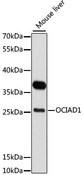 OCIAD1 Antibody - Western blot analysis of extracts of mouse liver, using OCIAD1 antibody at 1:3000 dilution. The secondary antibody used was an HRP Goat Anti-Rabbit IgG (H+L) at 1:10000 dilution. Lysates were loaded 25ug per lane and 3% nonfat dry milk in TBST was used for blocking. An ECL Kit was used for detection and the exposure time was 30s.