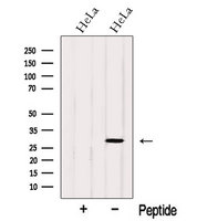 OCIAD1 Antibody - Western blot analysis of extracts of HeLa cells using OCIAD1 antibody. The lane on the left was treated with blocking peptide.