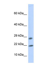 OCIAD2 Antibody - OCIAD2 antibody Western blot of 293T cell lysate. This image was taken for the unconjugated form of this product. Other forms have not been tested.