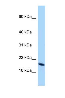 OCIAD2 Antibody - OCIAD2 antibody Western blot of Mouse Heart lysate. Antibody concentration 1 ug/ml.  This image was taken for the unconjugated form of this product. Other forms have not been tested.