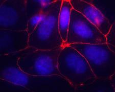 OCLN / Occludin Antibody - IF using Occludin Antibody, Alexa Fluor&amp;reg; 594, Alexa Fluor&amp;reg; 594 conjugate (OC-3F10)