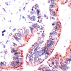 OCLN / Occludin Antibody - Human Lung stained with Anti-Occludin