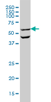 OCLN / Occludin Antibody - OCLN monoclonal antibody (M01), clone 1G7 Western Blot analysis of OCLN expression in HL-60.