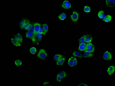 OCLN / Occludin Antibody - Immunofluorescence staining of MCF-7 cells at a dilution of 1:133, counter-stained with DAPI. The cells were fixed in 4% formaldehyde, permeabilized using 0.2% Triton X-100 and blocked in 10% normal Goat Serum. The cells were then incubated with the antibody overnight at 4 °C.The secondary antibody was Alexa Fluor 488-congugated AffiniPure Goat Anti-Rabbit IgG (H+L) .