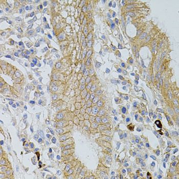 OCLN / Occludin Antibody - Immunohistochemistry of paraffin-embedded human stomach using OCLN antibody at dilution of 1:100 (40x lens).