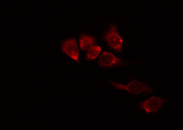 OCLN / Occludin Antibody - Staining HepG2 cells by IF/ICC. The samples were fixed with PFA and permeabilized in 0.1% Triton X-100, then blocked in 10% serum for 45 min at 25°C. The primary antibody was diluted at 1:200 and incubated with the sample for 1 hour at 37°C. An Alexa Fluor 594 conjugated goat anti-rabbit IgG (H+L) Ab, diluted at 1/600, was used as the secondary antibody.
