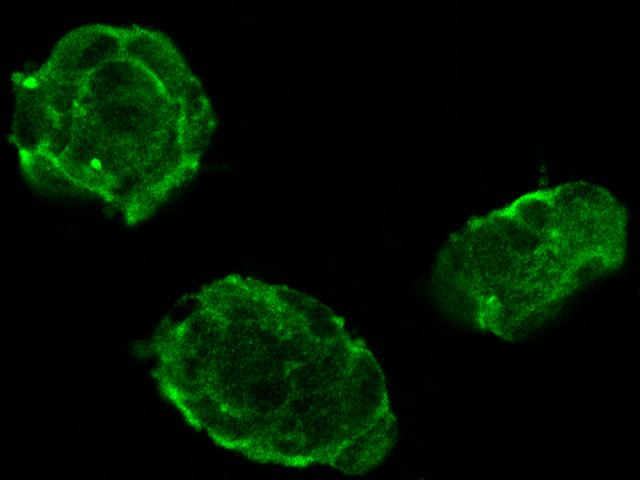 OCLN / Occludin Antibody - Immunofluorescence staining of OCLN in Hek293 cells. Cells were fixed with 4% PFA, blocked with 10% serum, and incubated with rabbit anti-Human OCLN polyclonal antibody (dilution ratio 1:1500) at 4°C overnight. Then cells were stained with the Alexa Fluor 488-conjugated Goat Anti-rabbit IgG secondary antibody (green). Positive staining was localized to cell membrane and cytoplasm.