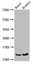 OCM / Oncomodulin Antibody - Positive WB detected in:Mouse heart tissue,Mouse kidney tissue;All lanes:OCM antibody at 3?g/ml;Secondary;Goat polyclonal to rabbit IgG at 1/50000 dilution;Predicted band size: 13 KDa;Observed band size: 13 KDa;