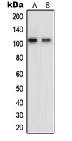 OCRL Antibody - Western blot analysis of OCRL expression in HeLa (A); KNRK (B) whole cell lysates.
